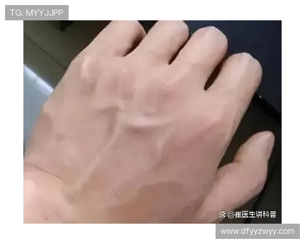 左右手力量差异暗藏健康密码:你的左手真的和右手一样有力吗?